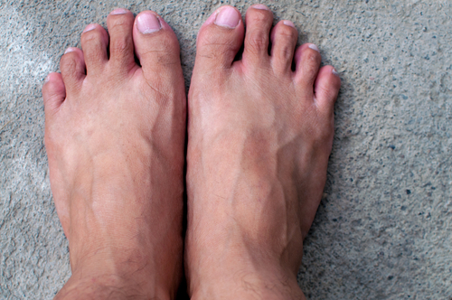 visible bulging veins in feet