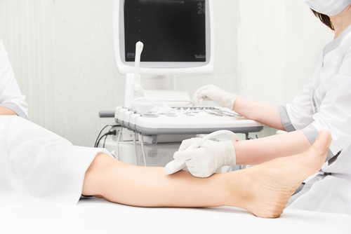 veinous ultrasound