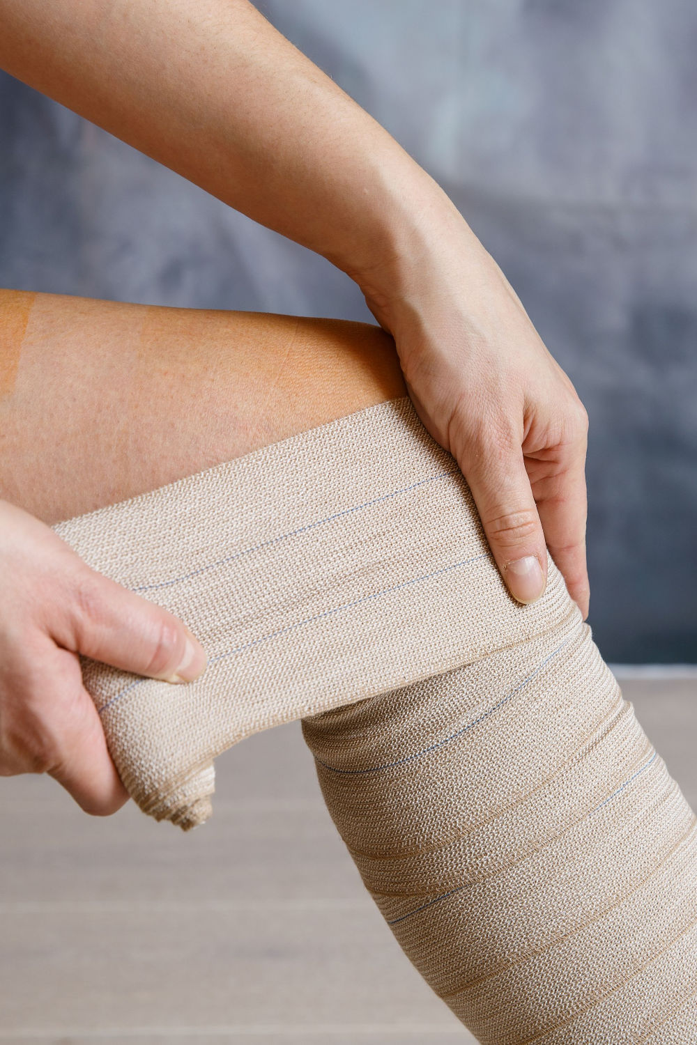 A woman wrapping her venous leg ulcer wounds