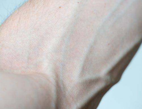 Why Some Veins Visibly ‘Pop Out’