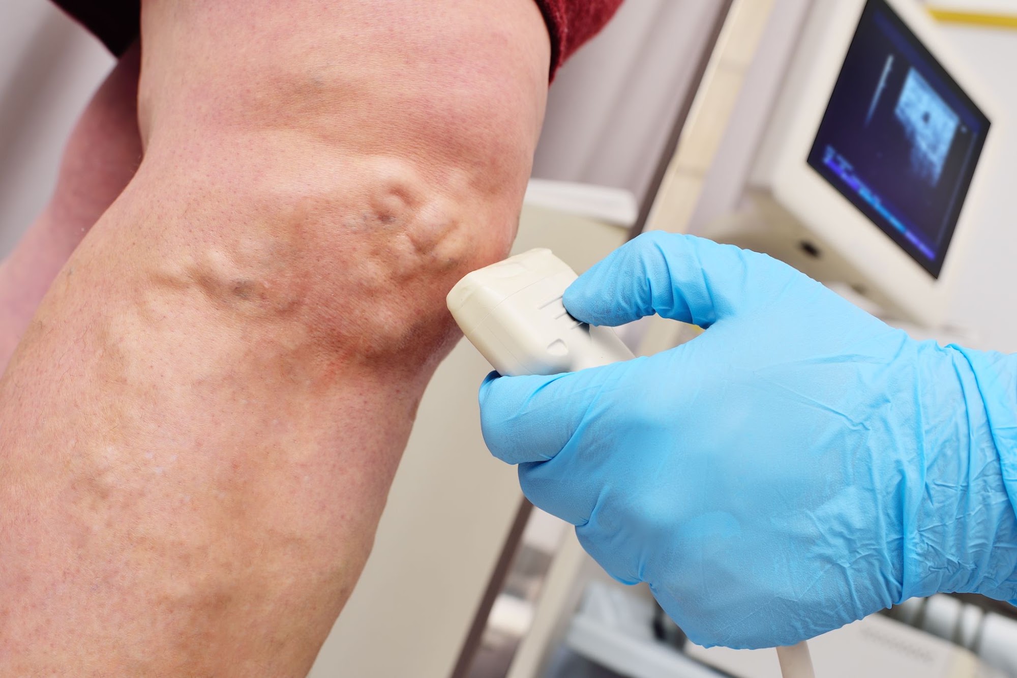 Vascular surgeon performing an ultrasound exam on a patient’s leg